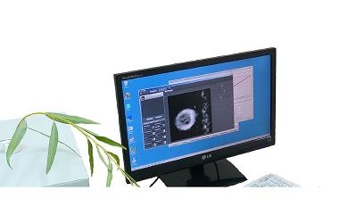 Низкопольный томограф "SpinVision"